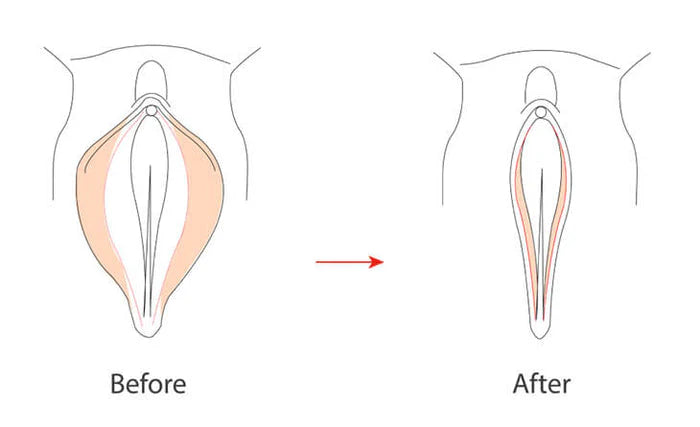 V-Tight - All Natural Instant Vaginal Tightening Spray - 50ml